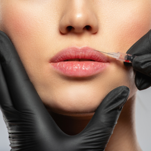 fillers